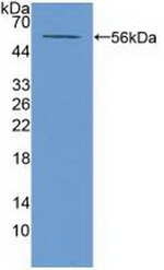 ABCA13 Polyclonal Antibody