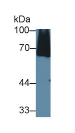 C8A Antibody in Western Blot (WB)