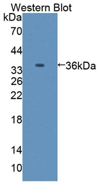 C8A Antibody in Western Blot (WB)