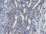 SREBP1 Polyclonal Antibody