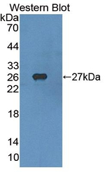 SREBP1 Antibody in Western Blot (WB)