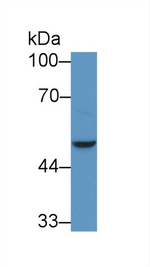 NADK Antibody in Western Blot (WB)