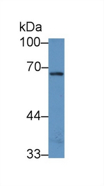NADK Antibody in Western Blot (WB)