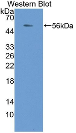 NADK Antibody in Western Blot (WB)