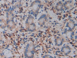 CD61 Antibody in Immunohistochemistry (Paraffin) (IHC (P))