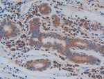 CD61 Antibody in Immunohistochemistry (Paraffin) (IHC (P))