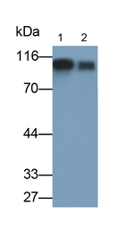 CD61 Antibody in Western Blot (WB)