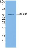 CD61 Antibody in Western Blot (WB)