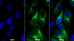 PDGFRA Polyclonal Antibody