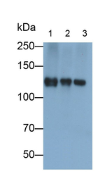 PDGFRA Antibody in Western Blot (WB)