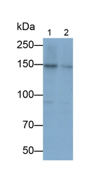 PDGFRA Antibody in Western Blot (WB)