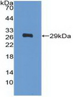 PDGFRA Antibody in Western Blot (WB)