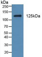 PDGFRA Antibody in Western Blot (WB)