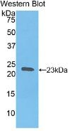 HBB Antibody in Western Blot (WB)