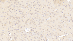 CaV1.2 Antibody in Immunohistochemistry (Paraffin) (IHC (P))