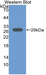 Tartrate Resistant Acid Phosphatase Antibody in Western Blot (WB)