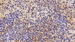 PTMA Antibody in Immunohistochemistry (Paraffin) (IHC (P))