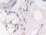 PTPRB Polyclonal Antibody