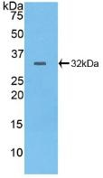 PTPRB Antibody in Western Blot (WB)