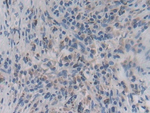 IFN epsilon Polyclonal Antibody