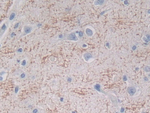 IFN epsilon Antibody in Immunohistochemistry (Paraffin) (IHC (P))