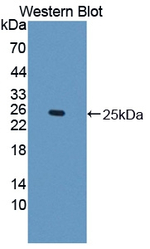 IFN epsilon Antibody in Western Blot (WB)