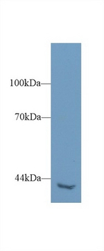 PLCH2 Polyclonal Antibody