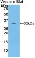PAK4 Antibody in Western Blot (WB)
