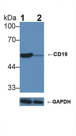 CD19 Antibody in Western Blot (WB)