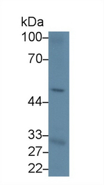 CD19 Antibody in Western Blot (WB)
