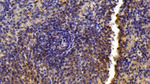 LXR beta Antibody in Immunohistochemistry (Paraffin) (IHC (P))
