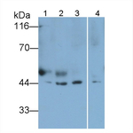 LXR beta Antibody in Western Blot (WB)