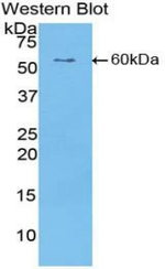 CILP Antibody in Western Blot (WB)