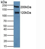 MGAM Antibody in Western Blot (WB)