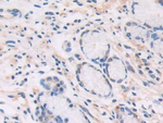 CECR1 Antibody in Immunohistochemistry (Paraffin) (IHC (P))
