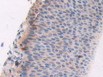 CECR1 Antibody in Immunohistochemistry (Paraffin) (IHC (P))
