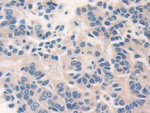 CECR1 Antibody in Immunohistochemistry (Paraffin) (IHC (P))