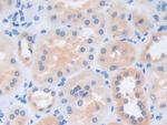 CECR1 Antibody in Immunohistochemistry (Paraffin) (IHC (P))