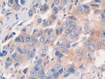 CECR1 Antibody in Immunohistochemistry (Paraffin) (IHC (P))