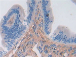 SERPINA3 Antibody in Immunohistochemistry (Paraffin) (IHC (P))