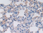 SERPINA3 Antibody in Immunohistochemistry (Paraffin) (IHC (P))