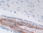 SERPINA3 Polyclonal Antibody