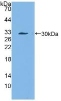 SERPINA3 Antibody in Western Blot (WB)
