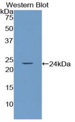 SMAD3 Antibody in Western Blot (WB)