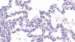 CFTR Antibody in Immunohistochemistry (Paraffin) (IHC (P))