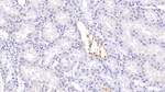 CFTR Polyclonal Antibody