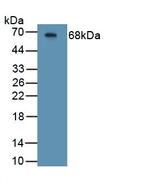 CFTR Antibody in Western Blot (WB)
