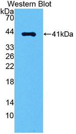 AGTR1 Antibody in Western Blot (WB)