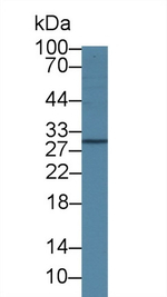 IL4R Antibody in Western Blot (WB)