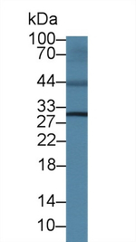 IL4R Antibody in Western Blot (WB)